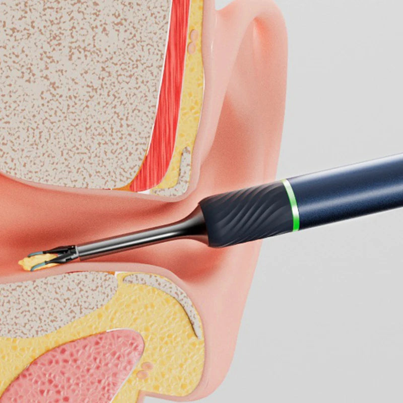 New DesignBebird Smart Ear Cleaner Health Ear Wax Removal Tool with Picker Endoscope for Earwax Cleaning
