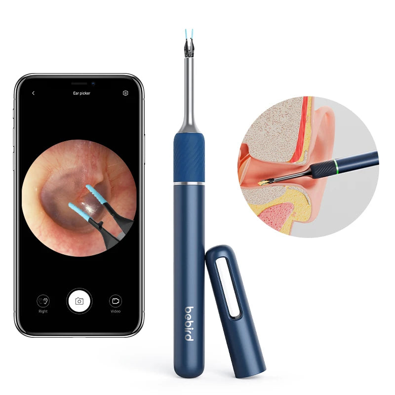 New DesignBebird Smart Ear Cleaner Health Ear Wax Removal Tool with Picker Endoscope for Earwax Cleaning